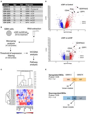 Human Cerebrospinal Fluid Modulates Pathways Promoting Glioblastoma Malignancy